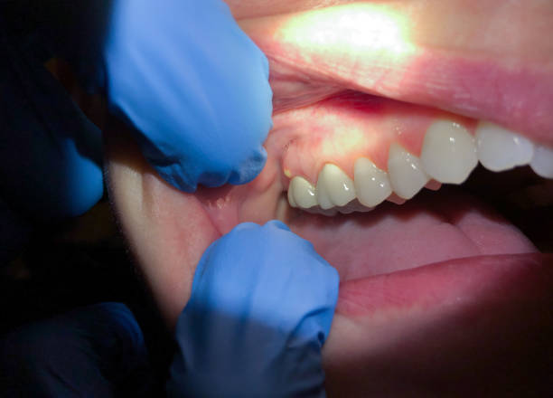 Best 24-Hour Emergency Dentist in Parkersburg, IA